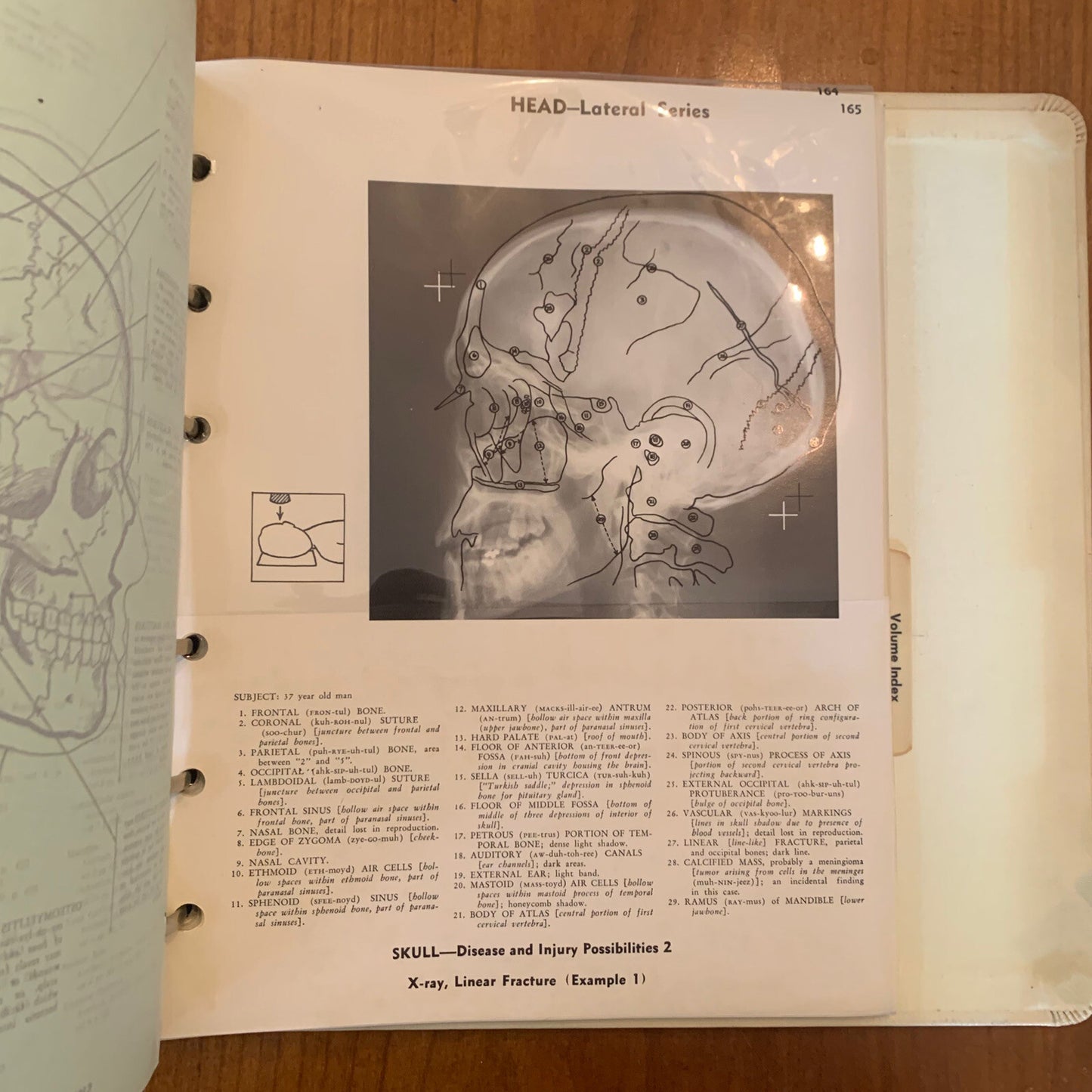 Medical Atlas For Attorneys / Courtroom Drawings / Harold Williams / 1960s Legal