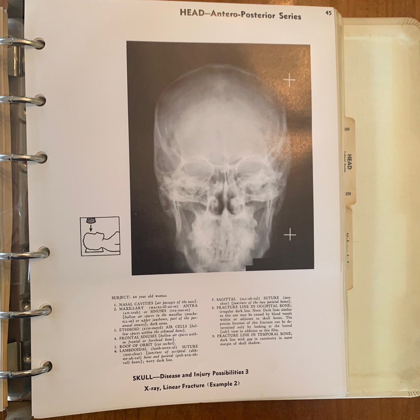 Medical Atlas For Attorneys / Courtroom Drawings / Harold Williams / 1960s Legal