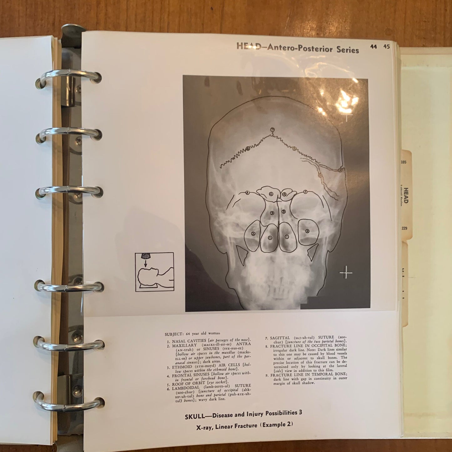 Medical Atlas For Attorneys / Courtroom Drawings / Harold Williams / 1960s Legal