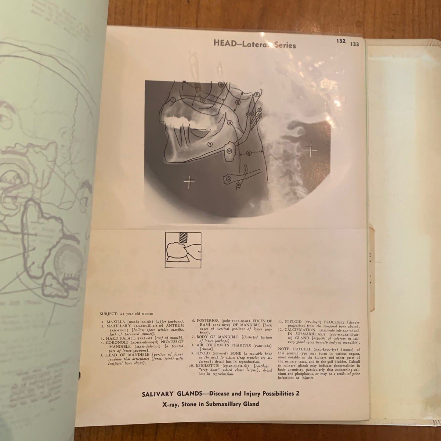 Medical Atlas For Attorneys / Courtroom Drawings / Harold Williams / 1960s Legal