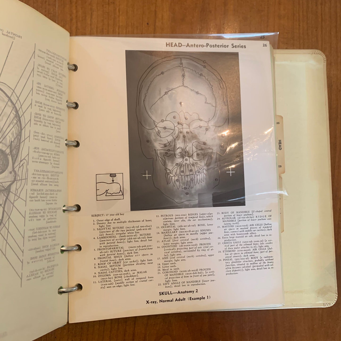 Medical Atlas For Attorneys / Courtroom Drawings / Harold Williams / 1960s Legal