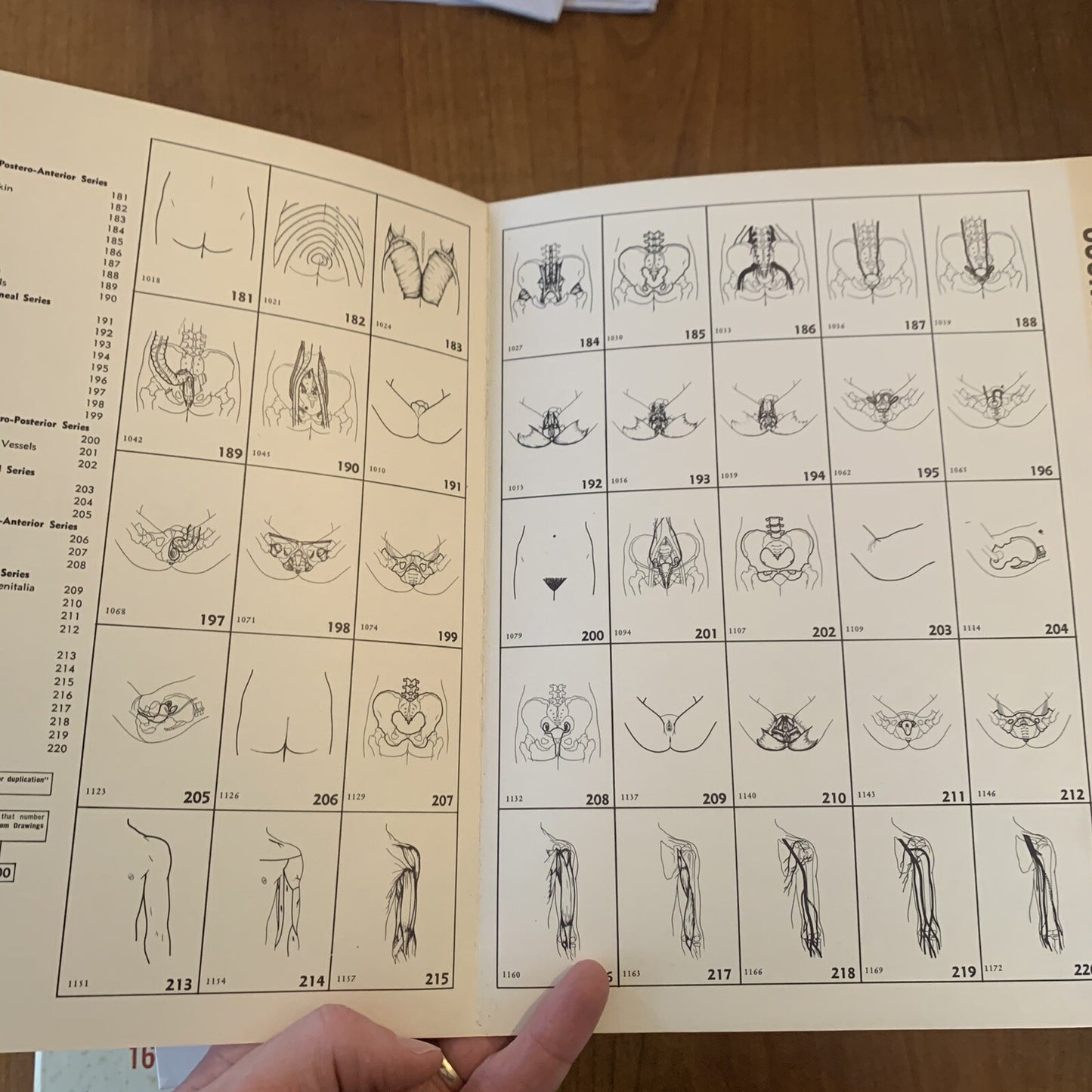 Medical Atlas For Attorneys / Courtroom Drawings / Harold Williams / 1960s Legal