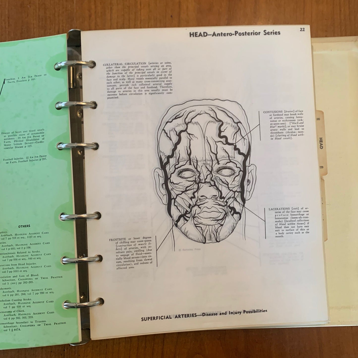 Medical Atlas For Attorneys / Courtroom Drawings / Harold Williams / 1960s Legal
